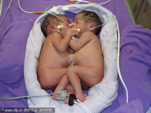 India Twins