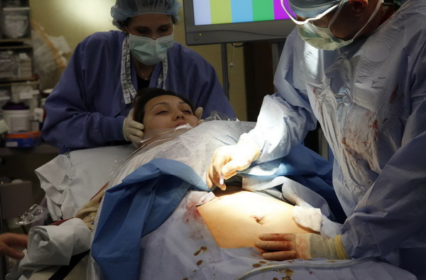 Mother and daughter go through gastric bypass