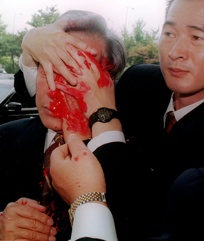 Photos: Celebrities who have been attacked