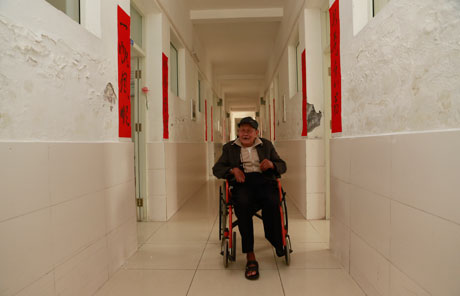 From one island to another: Living with leprosy in China