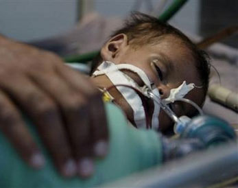 Surgeons operated on a 2-month-old Pakistani girl Tuesday to remove two fetuses that had grown inside her while she was still in her mother's womb, a doctor said. 