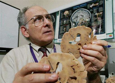 Barry Komisaruk, director of Minority Biomedical Research Support Program at Rutgers University, uses an actual human brain, that has been preserved and sliced, to talk about sexual responses in the brain, at UMDNJ Hospital in Newark, N.J., Sept. 1, 2005. (AP