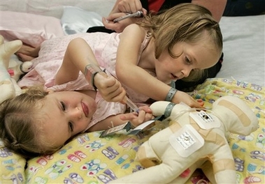 ,,Kendra,,,Maliyah,,conjoined twins,,