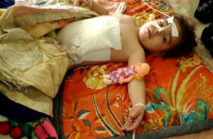 An injured Iraqi girl lies in hospital in Tal Afar, 420 kilometers (260 miles) northwest of Baghdad, Iraq, Saturday Dec. 9, 2006. The girl was injured when a suicide car bomber slammed into an Iraqi army checkpoint Friday afternoon killing two soldiers and one civilian while 15 others were injured including five children. (AP