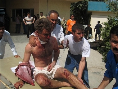 A bombing casualty from the village of Armili is brought to a hospital in Kirkuk, Saturday, July 7, 2007. A suicide bomber detonated a truck packed with explosives in an outdoor market Saturday, killing at least 23 people and wounding at least 86 others in a village of Shiite ethnic Turkomen, Armili, 165 kilometers (100 miles) north of Baghdad, Iraq. 
