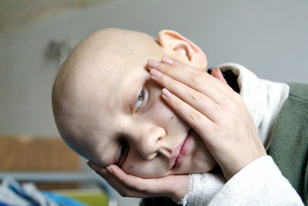 Chernobyl and oncological diseases in Donetsk