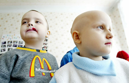 Chernobyl and oncological diseases in Donetsk