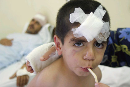 Children injured in Israeli raids