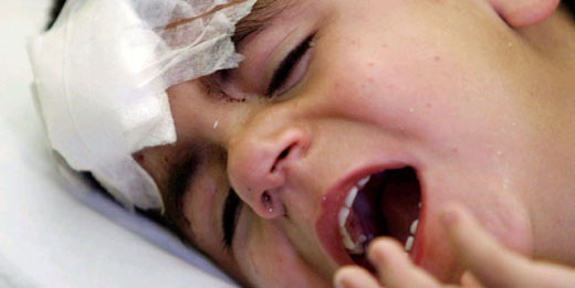 Children injured in Israeli raids