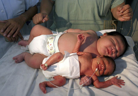 Big baby causes sensation in Mexican city