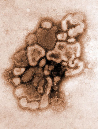 US health center studies swine flu virus