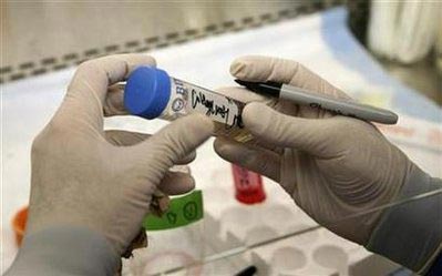 In muscle stem cells, age matters, study finds