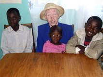 10,000 E. African albinos in hiding after killings