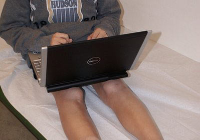 No laps for warm laptops; skin damage is possible