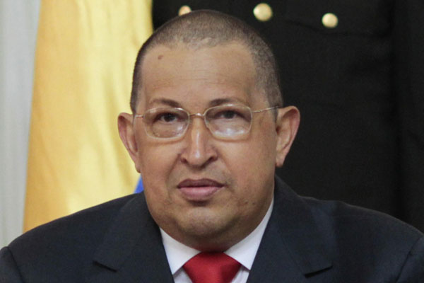Chavez loses hair from chemotherapy