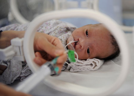 一对连体弃婴在广州得到成功救治