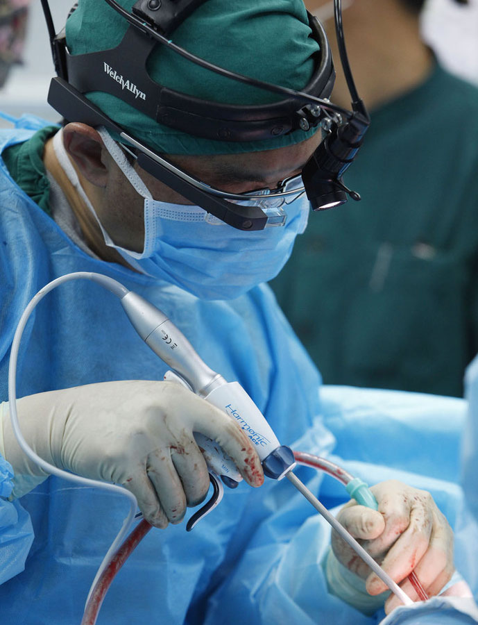 Chinese hospital uses Google Glass in surgery