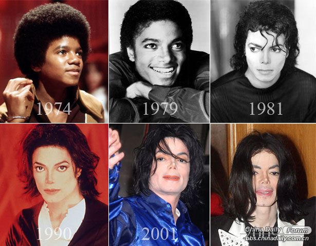 michael jackson before and after nose job