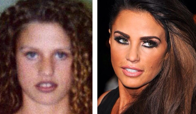 Worst celebrity plastic surgery fails