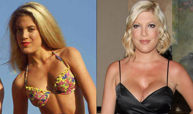 Worst celebrity plastic surgery fails