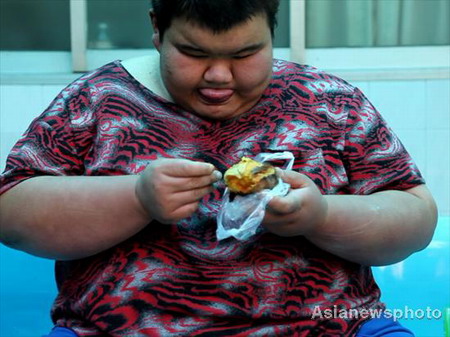 Obese man turns to medical treatment