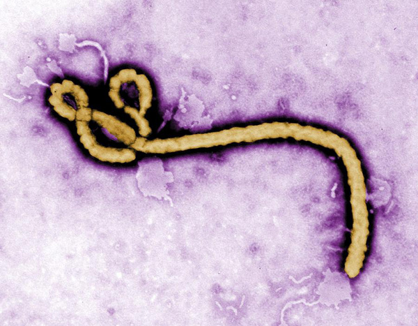 Experts ease fears of Ebola spread