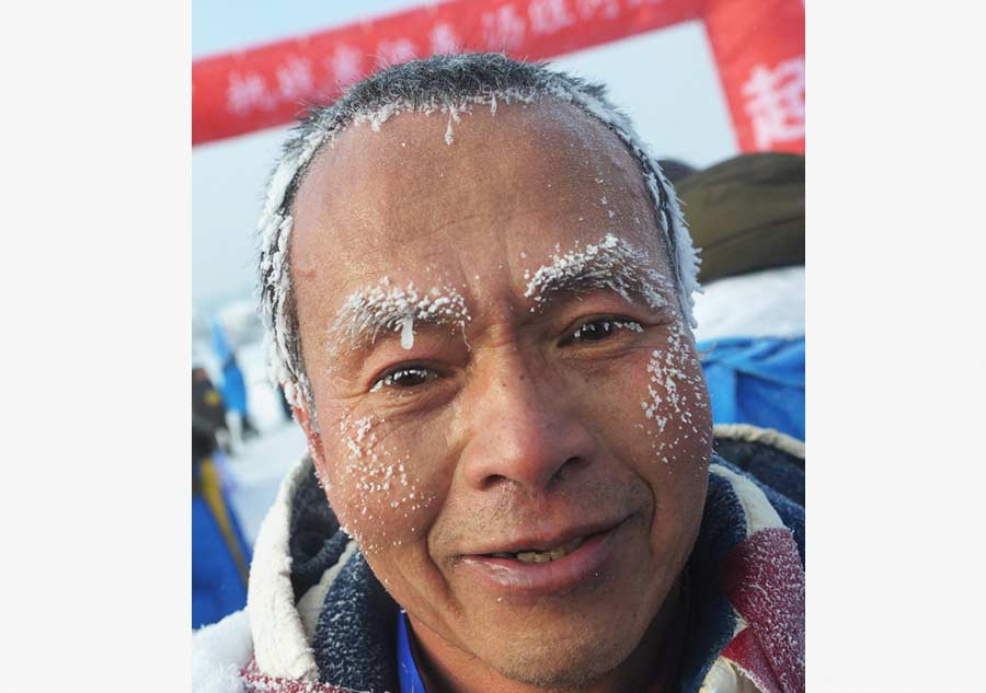 Hair, eyelashes turn white as temperature falls to minus 30 in  Heilongjiang[4]