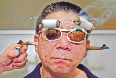 Acupuncture takes stab at UNESCO list