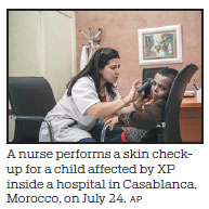 When sun is lethal: Moroccans struggle with skin illness