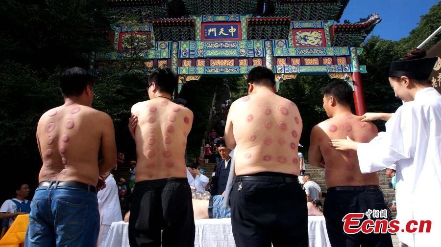 Free cupping therapy at Taoist mountain