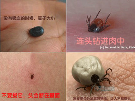 卫生部发布“蜱的特点及预防控制知识”