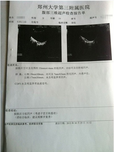 腹部b超报告单图片