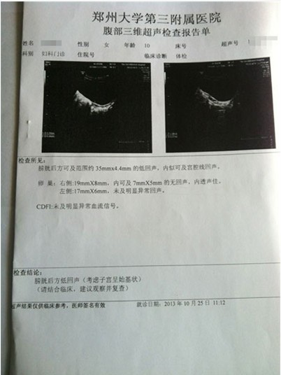 超声检查报告单图片图片