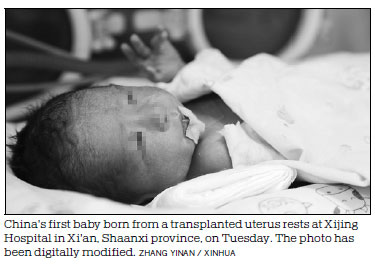 Woman gives birth from a uterus transplanted from her own mother