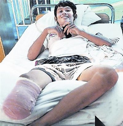 18岁印尼少年砍断自己小腿逃出地震废墟