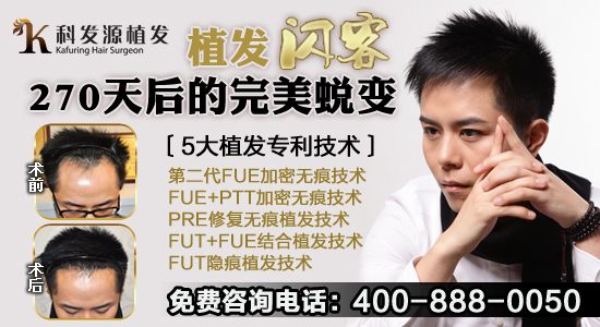 脱发的原因有哪些?科发源揭秘脱发三大原因