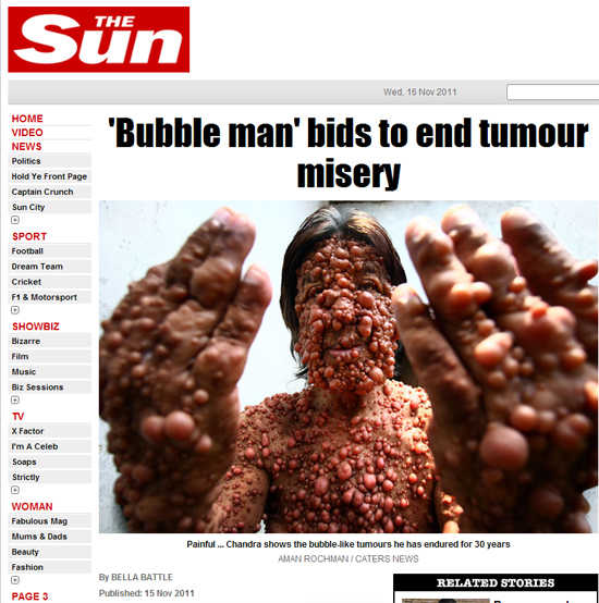 英国太阳报补缺