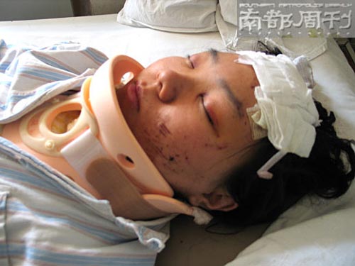 何洁车祸受伤照片曝光(图)