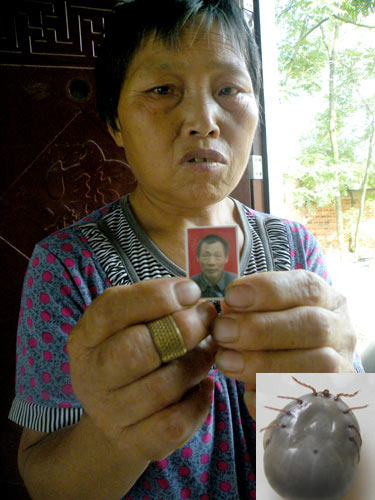 Henan villagers hit by tick-borne disease