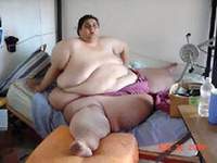 World's fattest man to be operated on with extra large surgical tools