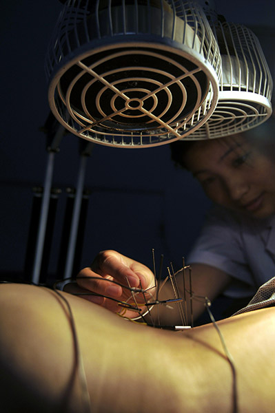 Acupuncture found to reduce period pain: study