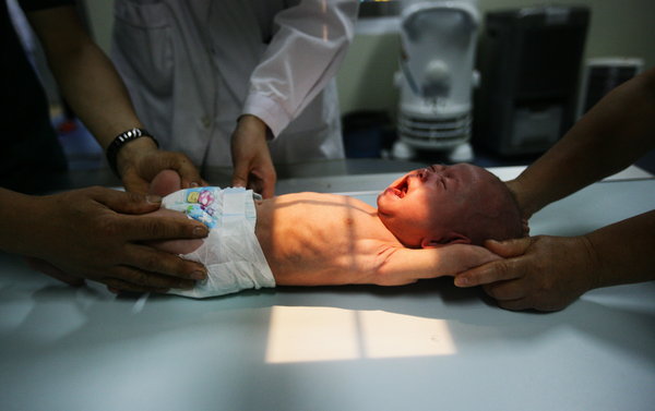 Infant with three legs abandoned in E China