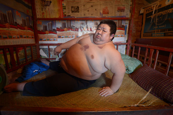 At 180kg, man becomes Chongqing's heaviest