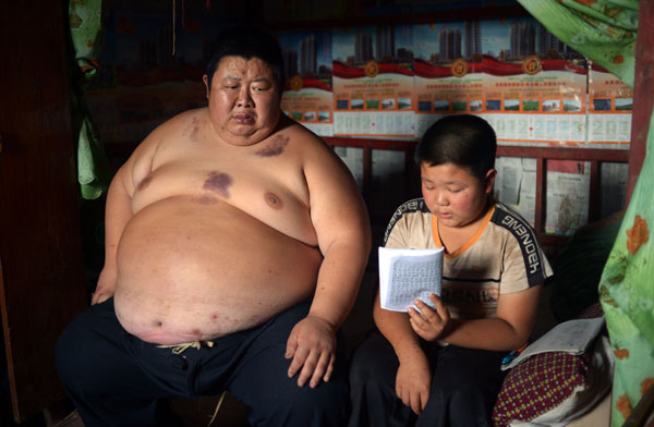 At 180kg, man becomes Chongqing's heaviest