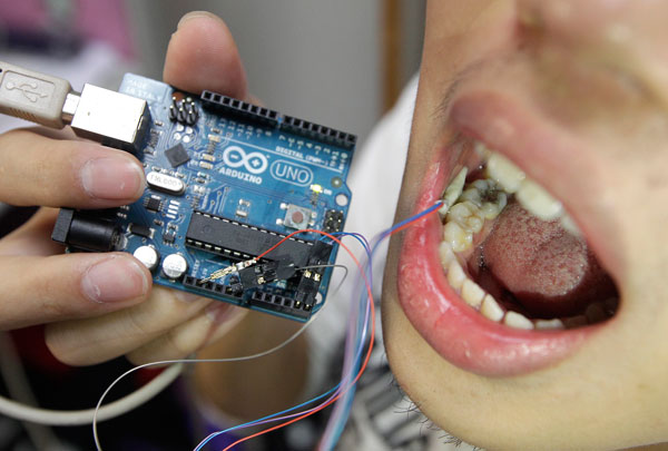 'Smart tooth' tracks daily habits