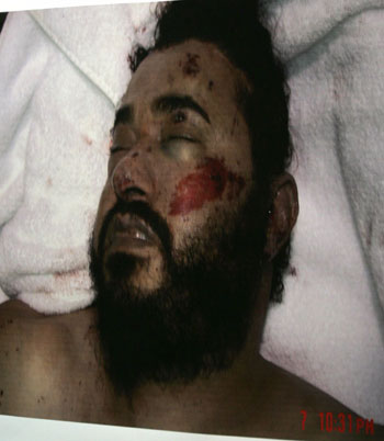 A picture of the dead al Qaeda leader in Iraq, Abu Musab al-Zarqawi, is displayed by the U.S. military during a news conference at the fortified Green Zone in Baghdad June 8, 2006. [Reuters]