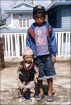 Nepal boy shortest in world