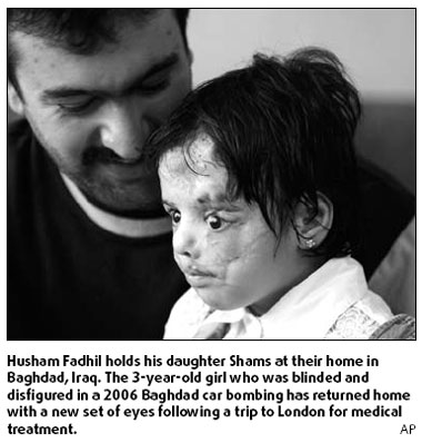 Blind Iraqi girl gets new eyes in London